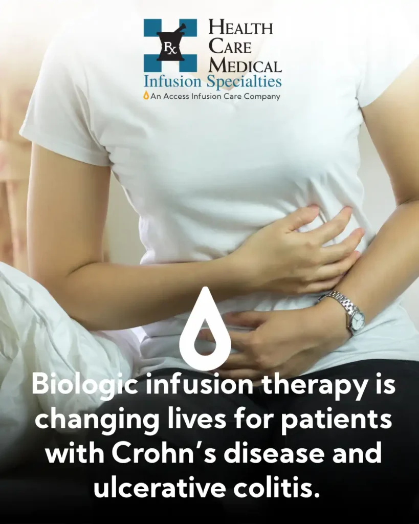 Infusion Therapy for Crohn's Disease and Ulcerative Colitis